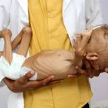 أكثر من6 الآف إصابة بالكوليرا في اليمن خلال أقل من عام