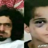 تفاصيل واقعة تعرض طفل لاعتداء وحشي في العاصمة اليمنية صنعاء
