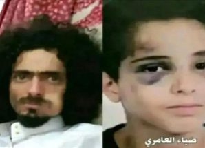 تفاصيل واقعة تعرض طفل لاعتداء وحشي في العاصمة اليمنية صنعاء