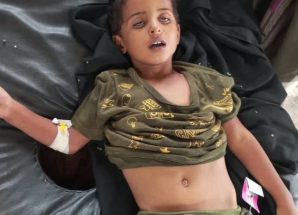 وفاة طفل بالإسهال المائي في الأزارق تثير مخاوف من تفشٍ وبائي