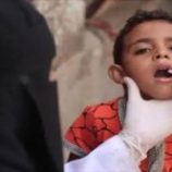منظمة الصحة العالمية تكشف عن تسجيل 25 حالة إصابة جديدة بشلل الأطفال في اليمن خلال إسبوع واحد فقط