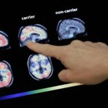 دراسة: الدماغ يحقق أعلى أداء له بين سن 55 و60 عامًا