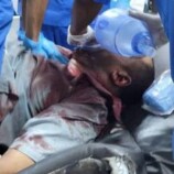 عاجل: ارتفاع حصيلة ضحايا إطلاق النار في مدينة عتق إلى 3 شهداء وأكثر من 18 جريحاً من المتظاهرين المدنيين.