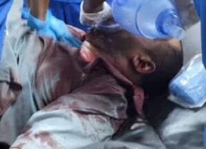 عاجل: ارتفاع حصيلة ضحايا إطلاق النار في مدينة عتق إلى 3 شهداء وأكثر من 18 جريحاً من المتظاهرين المدنيين.