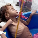 تقرير دولي يحذر من تفاقم خطر المجاعة في اليمن مع تصاعد التوترات الإقليمية