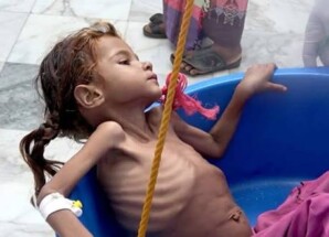 تقرير دولي يحذر من تفاقم خطر المجاعة في اليمن مع تصاعد التوترات الإقليمية