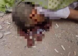 وفاة طبيب إثر سقوطه من الطابق الثالث بالعاصمة عدن