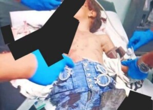 إصابة طفلة بجروح إثر انفجار بقايا مقذوف في الضالع